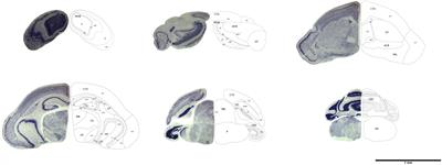 Histological and MRI brain atlas of the common shrew, Sorex araneus, with brain region-specific gene expression profiles